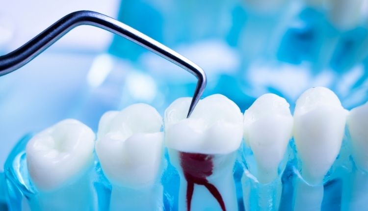 Endodonti Nedir